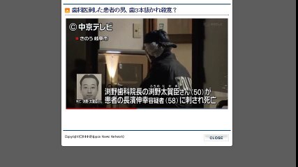 岐阜 歯科医刺した患者の男 歯３本抜かれ殺意 17 1 21 動画 Dailymotion