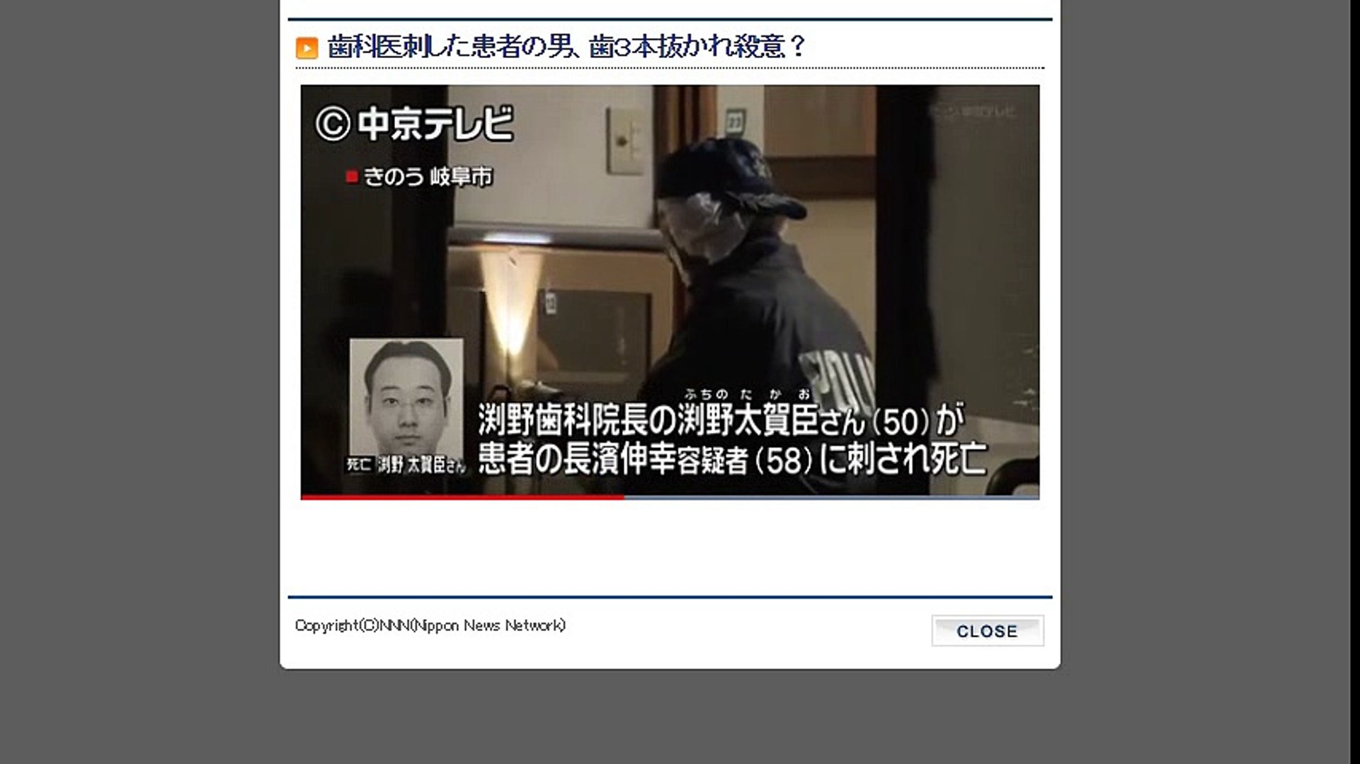 岐阜 歯科医刺した患者の男 歯３本抜かれ殺意 17 1 21 動画 Dailymotion