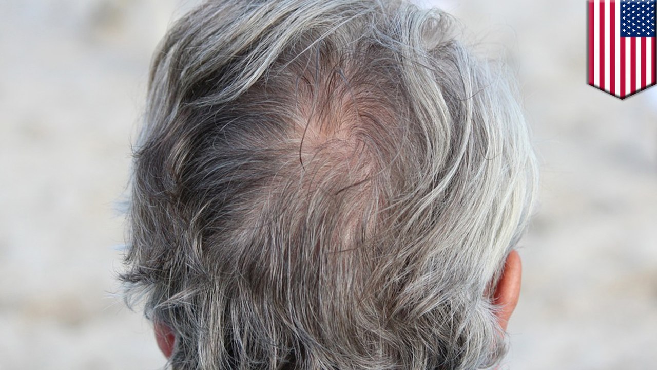 Scientists may have found a cure for gray hair and baldness