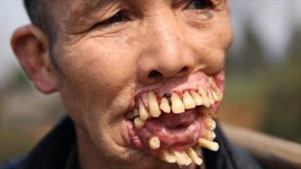 As mais bizarras doenças que você não sabe existirem! Imagens fortes!