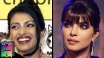 10 ممثلات هنديات بوليوود خضعن لعمليات التجميل