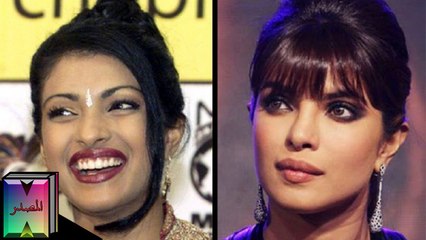 10 ممثلات هنديات بوليوود خضعن لعمليات التجميل