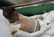 Cami Tuvaletinde Çakmak Gazı Patladı: 4 Çocuk Yaralı
