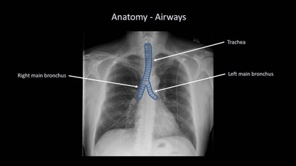 How to Interpret a Chest X-Ray (Lesson 2 - A Systematic Method and Anatomy)