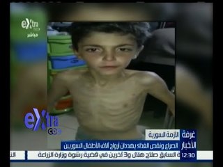 غرفة الأخبار | الصراع ونقص الغذاء يهددان أرواح الأطفال السوريين