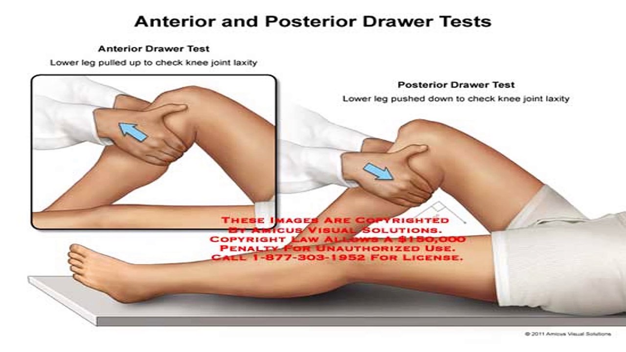 KNEE TESTS