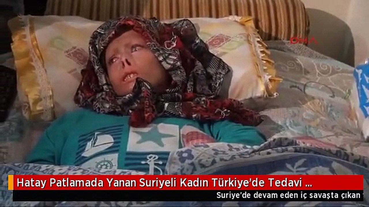 Hatay Patlamada Yanan Suriyeli Kadın Türkiye'de Tedavi Ediliyor