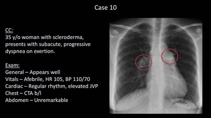 How to Interpret a Chest X-Ray (Lesson 10 - Self Assessment)_ Part 2