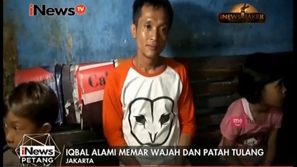 Kondisi Bocah Korban Penganiayaan di Tambora Masih Memprihatinkan