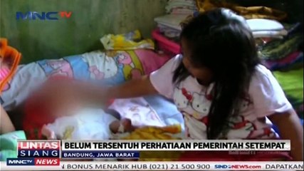 Bayi Menderita Hydrocepalus Belum Tersentuh Perhatian Pemerintah