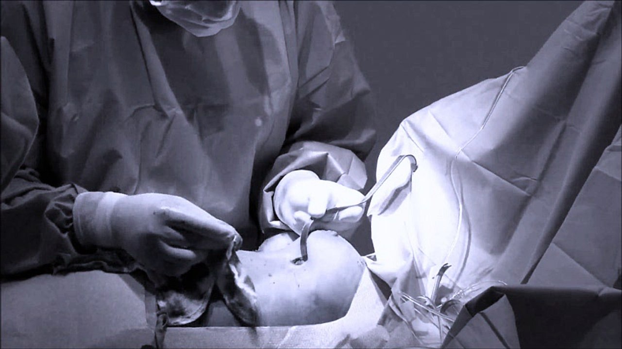 Dr. David Evdokimov Blog- My Breast Job Ruined My Life