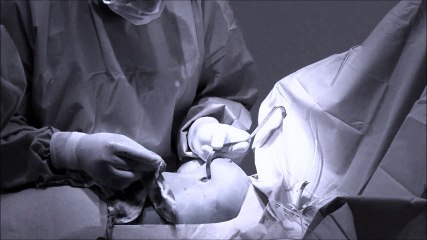 Dr. David Evdokimov Blog- My Breast Job Ruined My Life