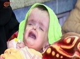 وباء الكوليرا يتنشر في صنعاء