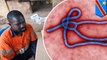 Ebola returns: Outbreak in DR Congo kills three people