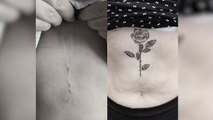 People Are Transforming Their Scars Into Beautiful Works Of Art