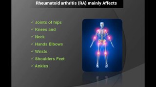 Rheumatoid Arthritis RA symptoms causes and diet from Dietkundali