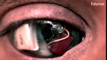 Si è fatto impiantare una microcamera nell'occhio che registrerà tutto il resto della sua vita