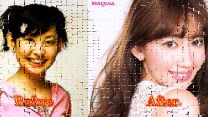 【AKB・整形】大改造！！整形メンバーBefore → After 大公開!!