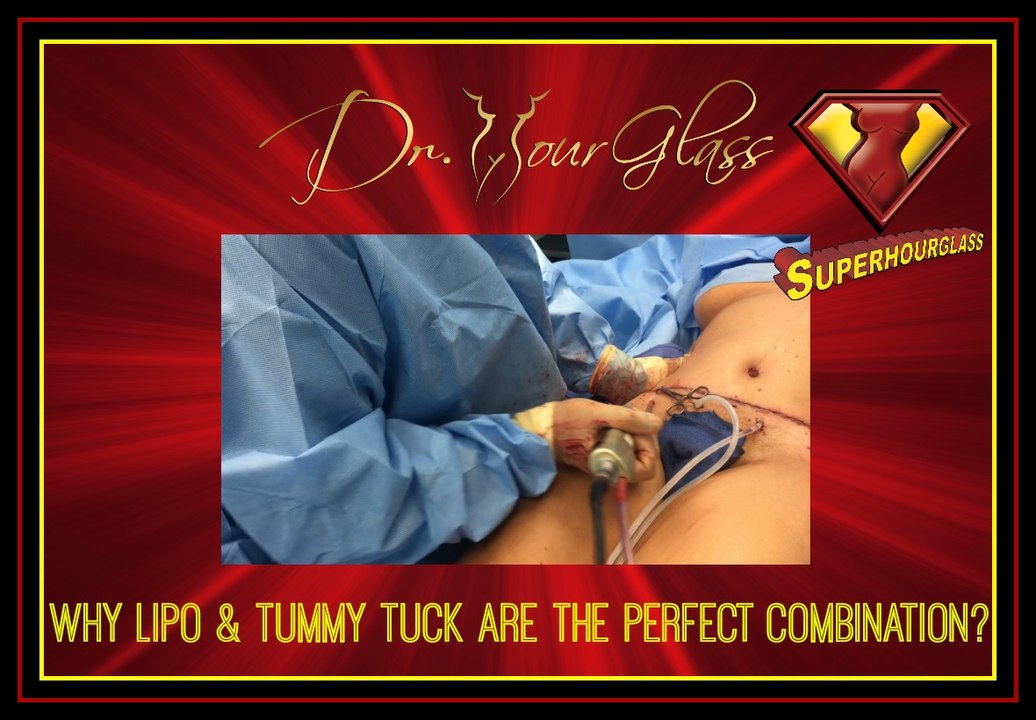 Why liposuction and tummy tucks are the perfect combination