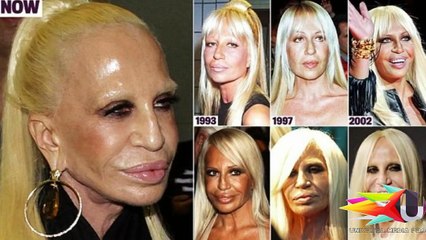 15 Extremely Shocking Plastic Surgery Disasters EVER !......http://www.dailymotion.com/video/x5m6p4d_love-make-the-people-helpless-mark-of-the-beast-al-law-new-world-order-antichrist-lust-sin-pope-fran_fun