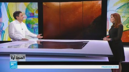 هل تختلف درجات ترهل الرقبة بين امرأة وأخرى؟