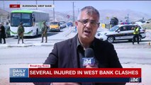 DAILY DOSE | Several Injured in West Bank clashes | Thursday, May 18th 2017