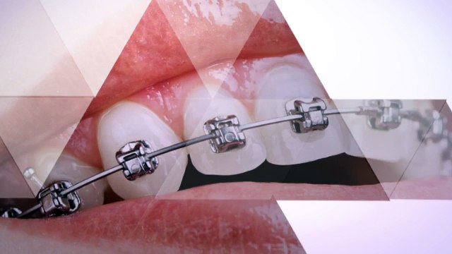 Cosmetic Dentistry Options in Ventura