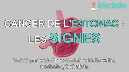 Cancer de l'estomac : les signes qui doivent inquiéter
