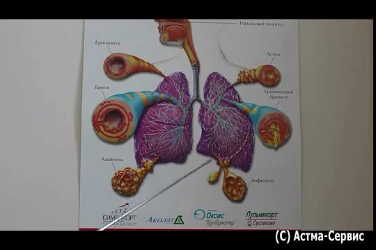 Астма бронхиальная лечение, признаки причины. Как вылечить астму