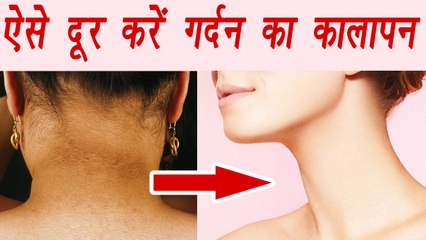 Download Video: Dark Neck Home Remedies | ऐसे दूर करें गर्दन का कालापन | Boldsky