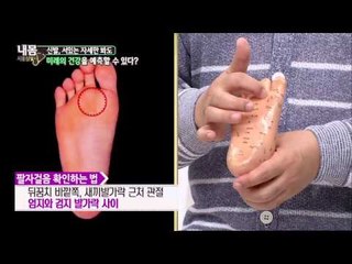 팔자 걸음 확인법, 심각성과 일어날수 있는 병들?! [내 몸 사용 설명서] 57회 20150704