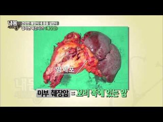 췌장암, 걸리면 죽는다?! [내몸사용설명서] 41회 20150312