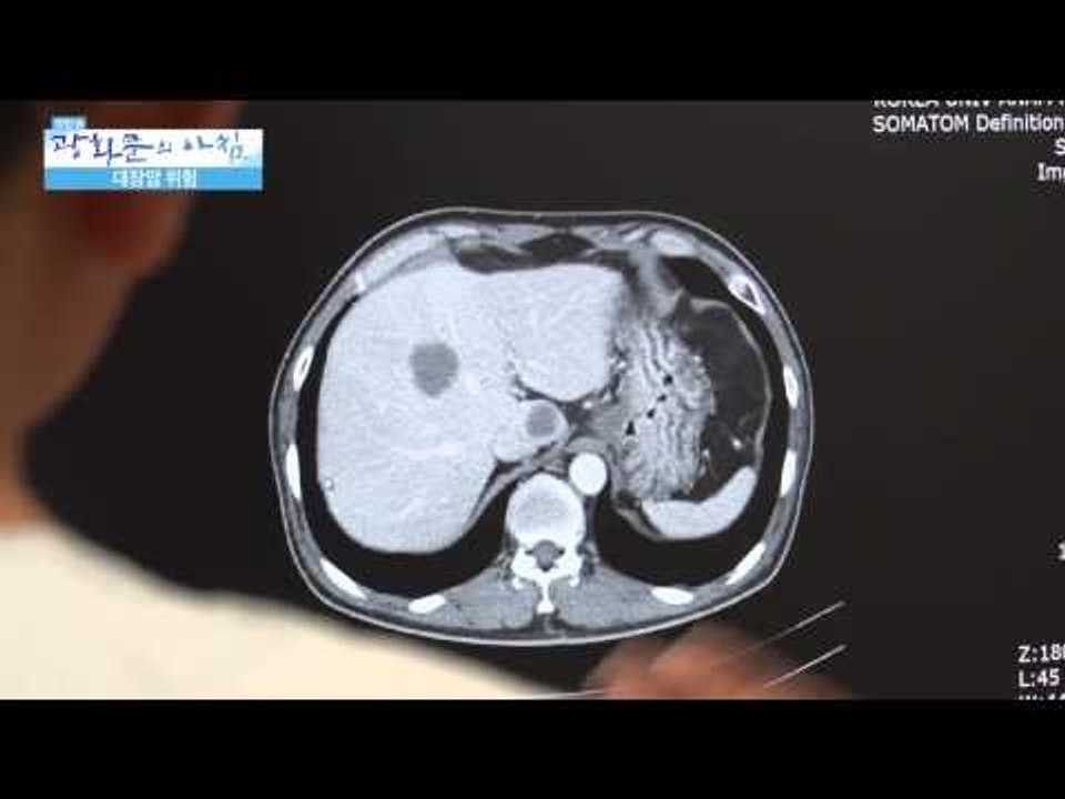 대장암 발병의 원인은? [광화문의 아침] 6회 20150615