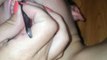 Une maman extirpe 27 ongles des gencives de son fils