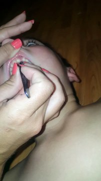 Une maman extirpe 27 ongles des gencives de son fils