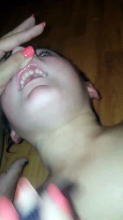 Cette maman va retirer 27 ongles des gencives de son fils... Toujours envie de te ronger les ongles?