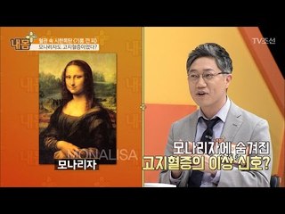 모나리자도 고지혈증이었다? [내 몸 플러스] 59회 20170521