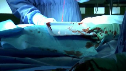 Children's Hospital S01E05 Nut Cutters