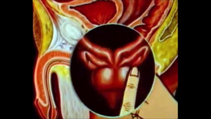Массаж простаты в домашних условиях. Как правильно делать массаж простаты. Массажер для простаты