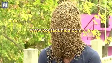 Nin Hindi ah oo Wejigiisa ay Fuushay 60 kun oo Shinni ahi