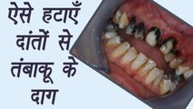 How to remove tobacco spots from teeth | ऐसे हटाएँ दांतों से तंबाकू के दाग | Boldsky