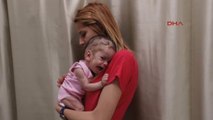 Gaziantep Mezarlığa Bırakılan 2 Beyin Ameliyatı Olan 'Kader' Bebek, Yaşama Tutundu