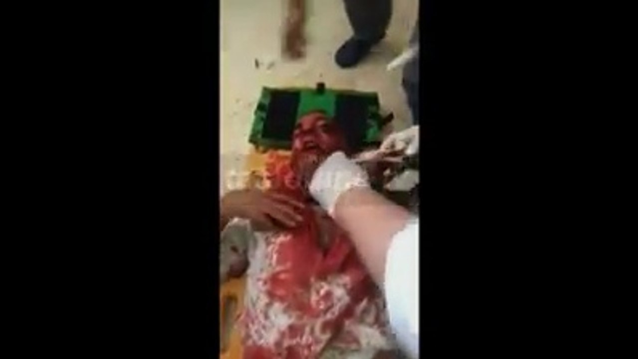 الكامور تعرض "شاب" لعملية دهس من قبل سيارة أمنية (فيديو)