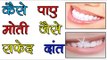 कैसे पाए मोती जैसे सफ़ेद दांत || Health Tips Gyan In Hindi || Tips for White Teeth