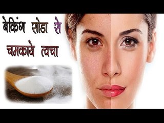 बेकिंग़ सोडा से चमकाए त्वचा || Health Education || Health Tips By Shristi