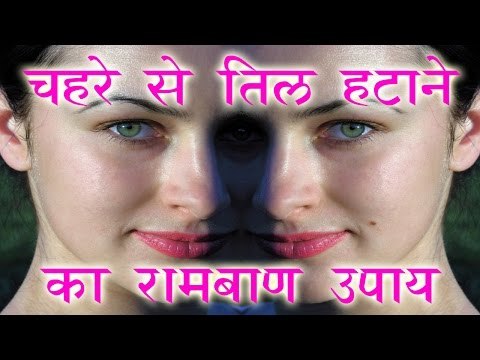 चेहरे से तिल हटाने का रामबाण उपाय || How To Remove Flat Moles From Face || Health Tips