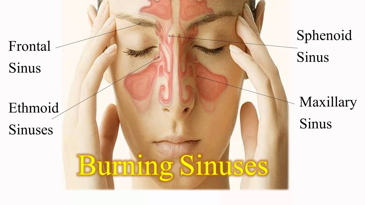 Burning Sinuses