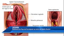 Une patiente accable un chirurgien du CH de Manosque : « il a suturé mes lèvres dans mon vagin »