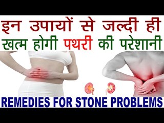 अगर हैं पथरी  की समस्या तो करें इन घरेलू उपायों से इलाज | Home Remedies For Stone In Hindi