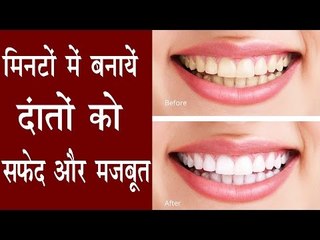 यह उपाए मिनटों में दांतों को चमका देगें मोतियों जैसा | How To Get White Teeth At Home